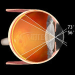 Volk Pan Retinal 2.2 Lens, Clear